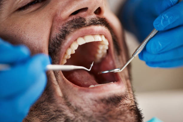 Best Emergency Gum Pain Relief  in Crete, NE